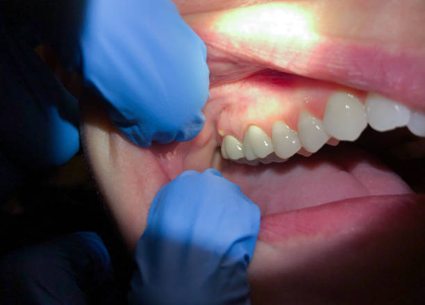 Best Emergency Orthodontic Repairs in Englewood, TN